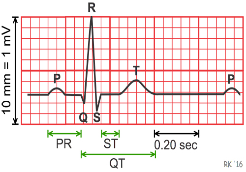 ECG trace with grid copy