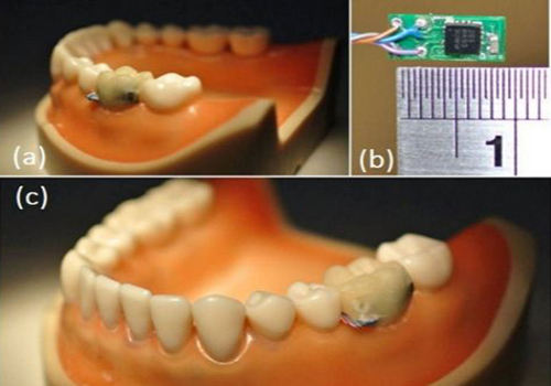دندانهای دیجیتال دوره آموزش تعمیر تجهیزات پزشکی و دندانپزشکی
