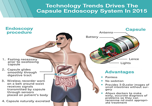Technology Trends Drives The Capsule Endoscopy System In 2015